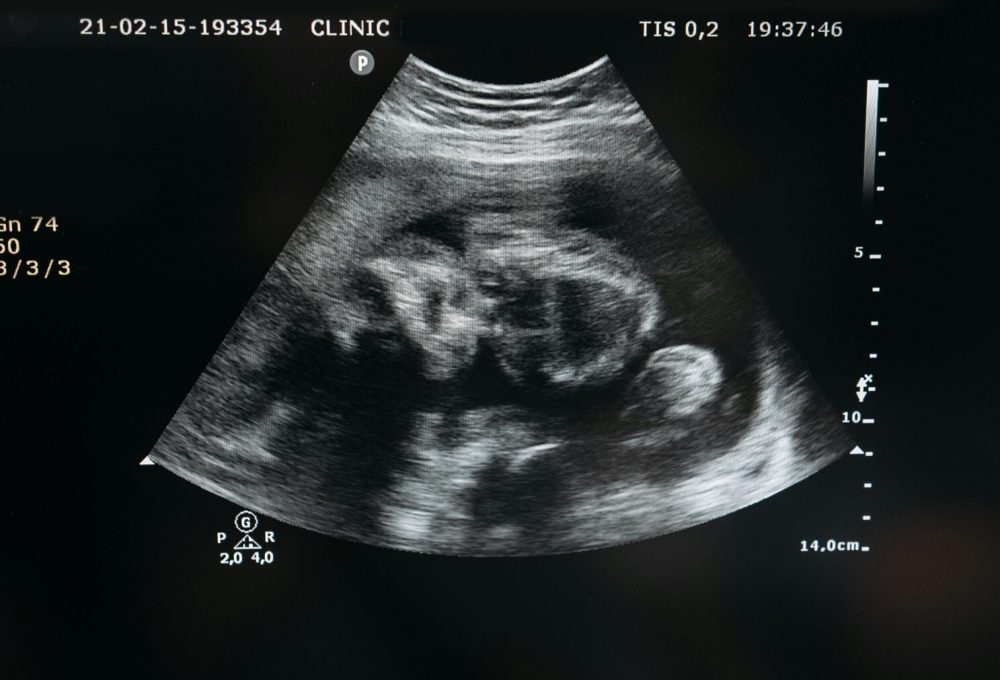 pexels-pavel-danilyuk-7108416