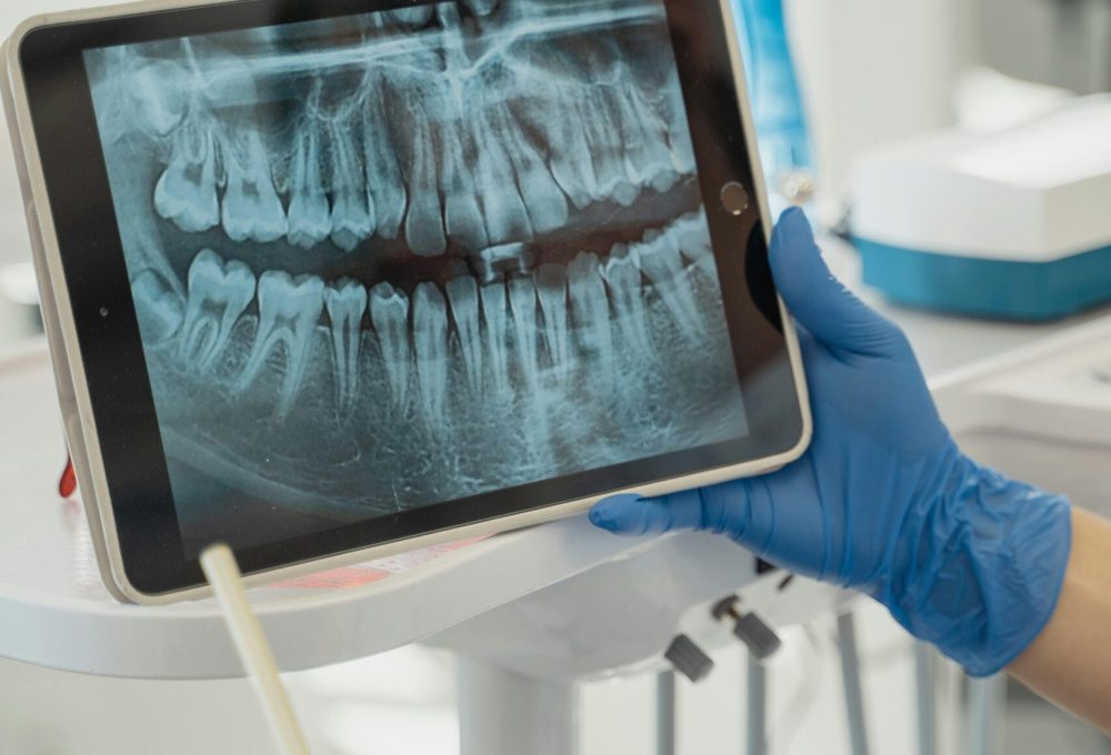 pexels-tima-miroshnichenko-5355695